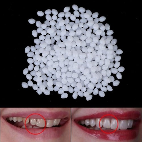10g/100g Teeth And Gap Falseteeth Solid Glue Resin Denture Adhesive Teeth  Dentist Falseteeth Solid Glue Temporary Tooth