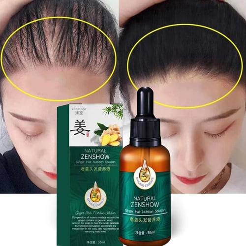 Ginger Hair Treatment Essential Oil Essence Original Genuine 100% Hair Loss  Liquid Health and Beauty Thick Hair Growth Essence - buy Ginger Hair  Treatment Essential Oil Essence Original Genuine 100% Hair Loss